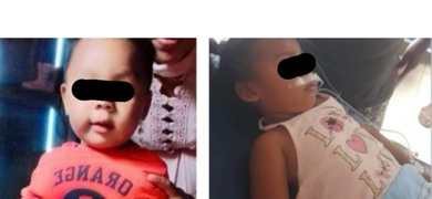 niños envenenados en nicaragua