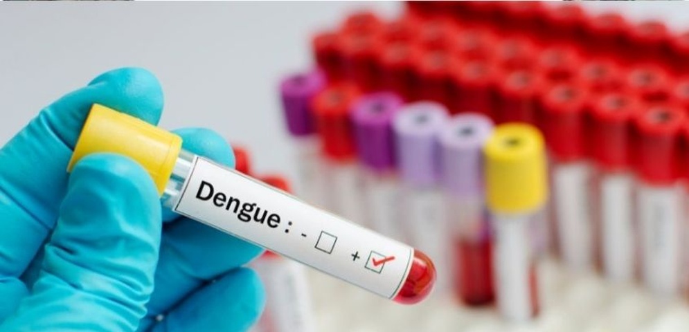 casos confirmados dengue nicaragua