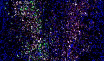 Expresión de varios genes y proteínas (blanco, rojo y verde) en las neuronas entre las células cerebrales de los ratones (azul).