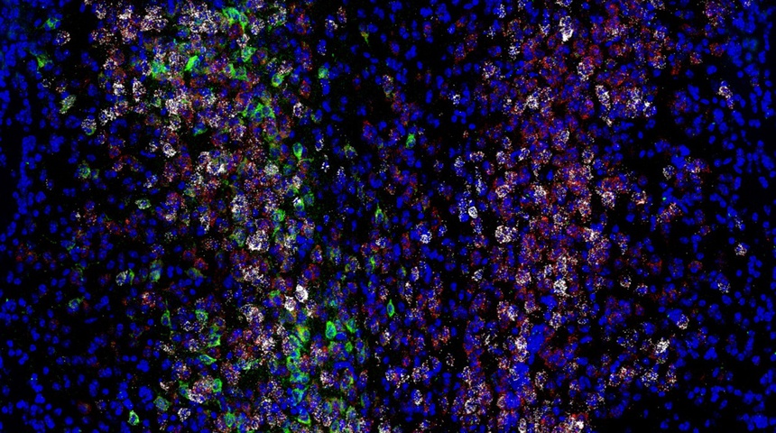 Expresión de varios genes y proteínas (blanco, rojo y verde) en las neuronas entre las células cerebrales de los ratones (azul).