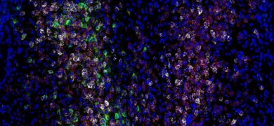 Expresión de varios genes y proteínas (blanco, rojo y verde) en las neuronas entre las células cerebrales de los ratones (azul).