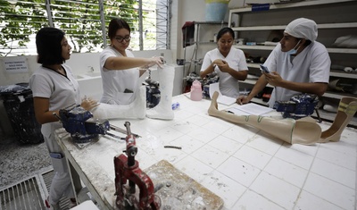 elaboracion protesis lisiados guerra el salvador