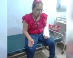 trabajadora ingenio san antonio chinandega herida brazos