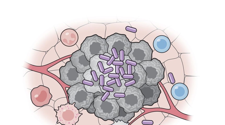 culula bacteriana contra cancer