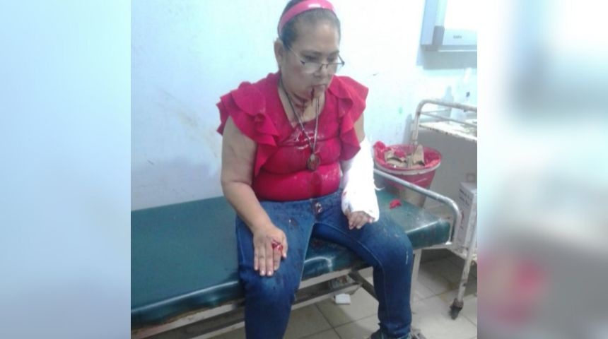 trabajadora ingenio san antonio chinandega herida brazos