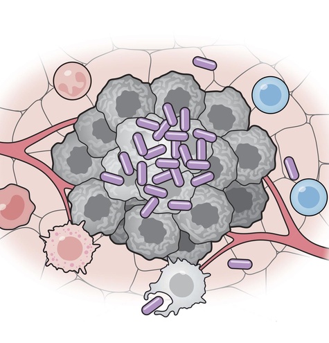 culula bacteriana contra cancer