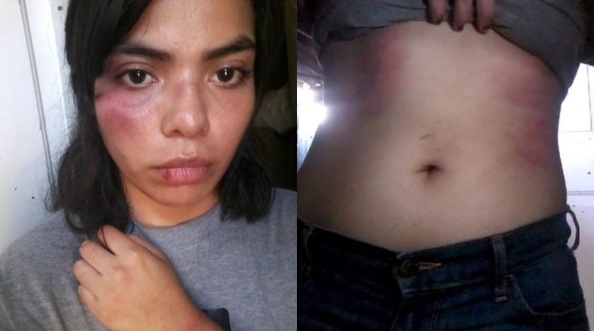 Golpeada aparece Valeska Alemán Sandoval