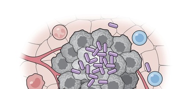 culula bacteriana contra cancer