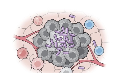 culula bacteriana contra cancer