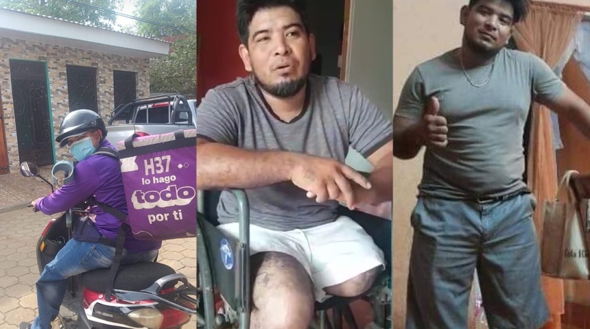 Cristian, un repartidor de comida rápida que pide ayuda para reparar sus prótesis y volver a trabajar