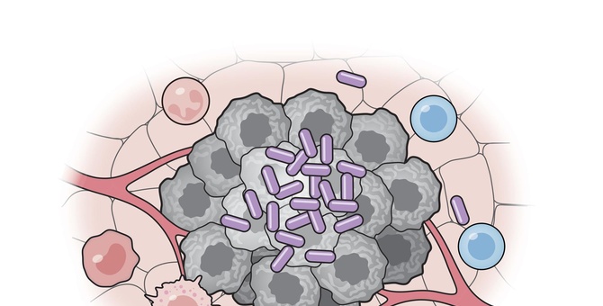 culula bacteriana contra cancer