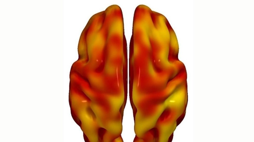 El riesgo cardiovascular y el declive cerebral se asocian en la mediana edad