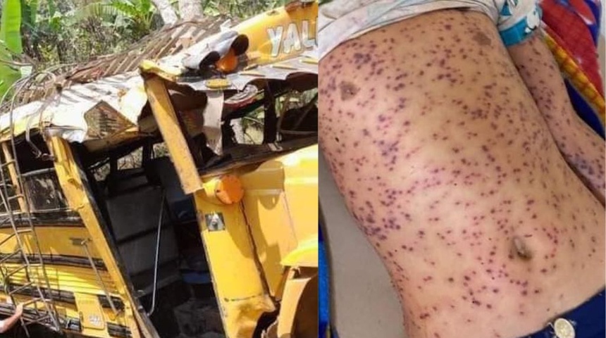 Cuatro muertos por picaduras de abejas al caer bus a barranco en Yalí, Jinotega