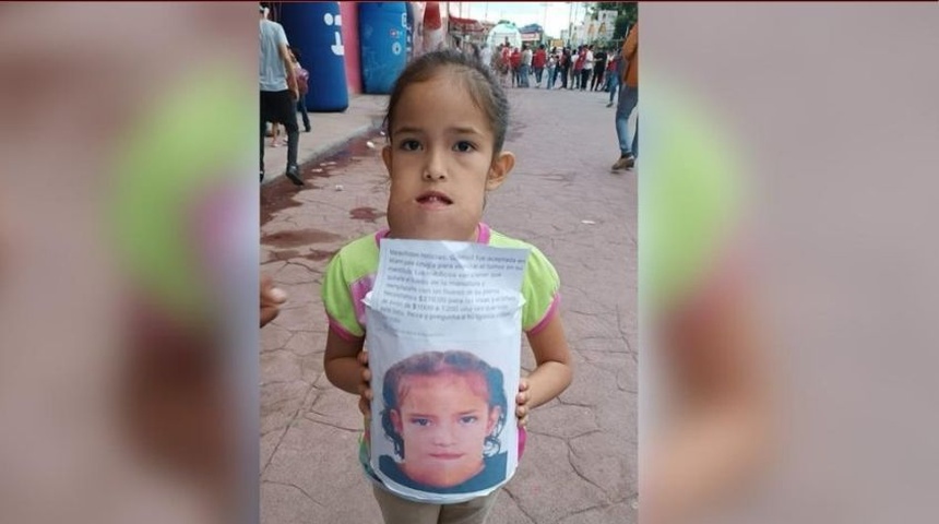 Niña con tumor en la mandíbula viajará a EEUU gracias a donativos