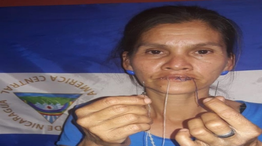 Asedian a mujer que se cosió la boca en protesta por presos políticos en Nicaragua