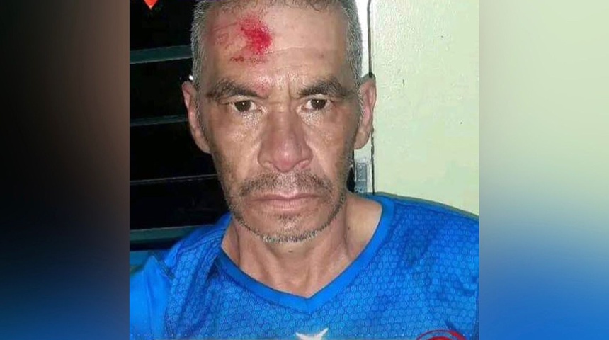 Machetean a joven por rechazar propuesta de matrimonio en Pueblo Nuevo, Estelí