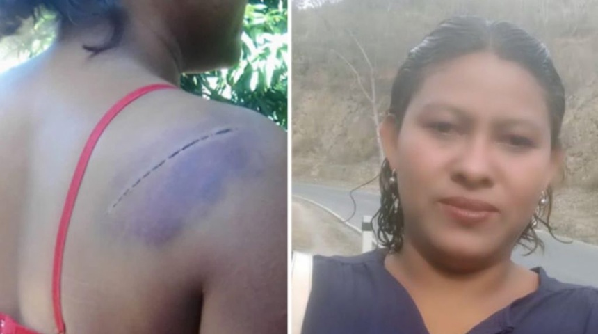 Mujer es agredida en Nueva Guinea por su expareja a machetazos