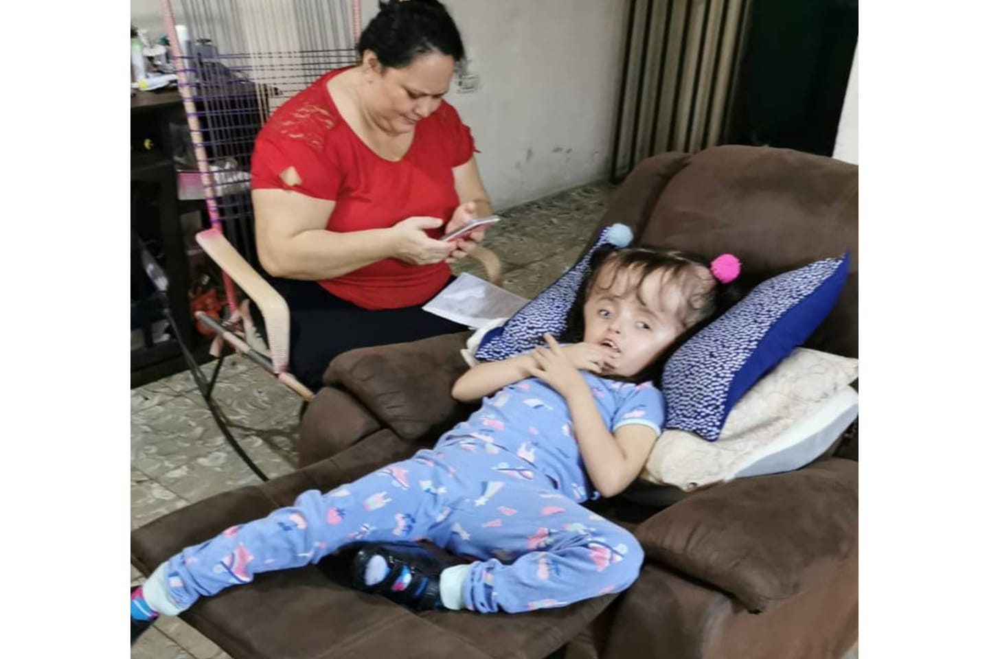 niña nicaragüense con hidrocefalia